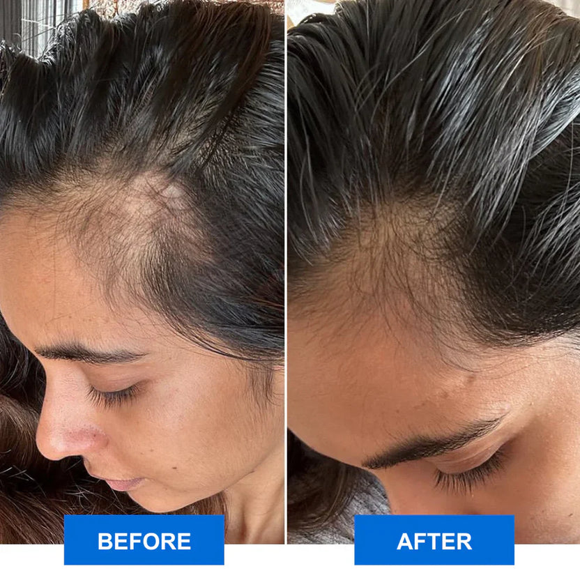 Before and After
