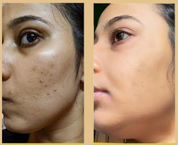 Before After